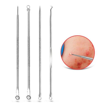 Blackhead Remover 4-in-1 Stainless Steel Pimple Extractor Tool (1 Pc)